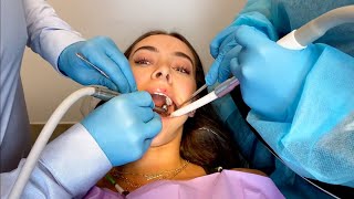 Injection Dental Drilling Extraction on Beautiful Girl [upl. by Shimkus344]