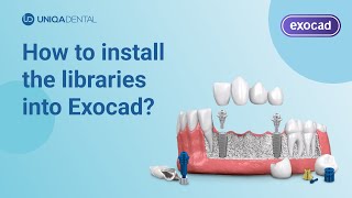 How to install the libraries into Exocad  exocad multi unit library  exocad implant library [upl. by Melesa87]