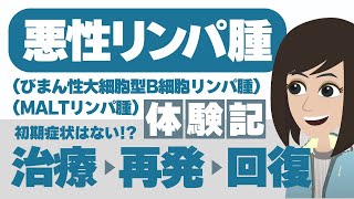 【悪性リンパ腫（MALTリンパ腫・びまん性大細胞型B細胞リンパ腫）】自覚症状はなかった…！？ [upl. by Laise]