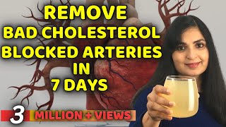 Remove Bad Cholesterol Naturally amp Reduce Clogged Arteries and Stroke  Samyuktha Diaries [upl. by Nevs]