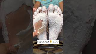 1 Day Repair FeetHand Fair Wrinkles free feet Parlor like feet at home padicure wax skincare [upl. by Selia]