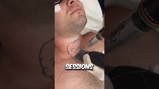 How Exactly Does Laser Tattoo Removal Actually Work 😳 [upl. by Anoy317]