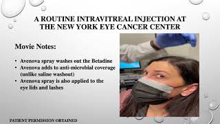 Eye Cancer Specialist New Intravitreal Injection Methods [upl. by Mcgray]