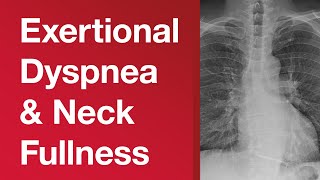 Middleaged Man With Exertional Dyspnea and Neck Fullness [upl. by Quartana]