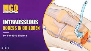 Intraosseous Access in Children General Pediatrics [upl. by Akiemehs]