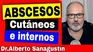 𝗔𝗕𝗦𝗖𝗘𝗦𝗢𝗦 causas síntomas y tratamiento [upl. by Anayaran]