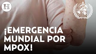 ¿Nueva pandemia se avecina OMS evalúa declarar el virus mpox como emergencia sanitaria mundial [upl. by Clarisa253]