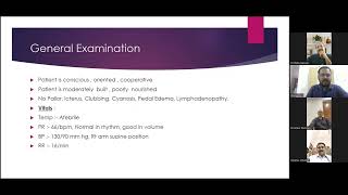 FLUENT CASE CARCINOMA HYPOPHARYNX [upl. by Cestar605]