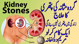 Gurdy Masana ki Pathri ka Ilaj  kidney stones Have Diffrent TypesBladder Stonby hkeem M asif [upl. by Rior318]