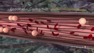 Acute Inflammation Educational 3D Animation [upl. by Ahseryt]