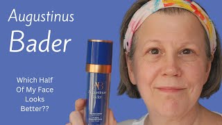 Using Augustinus Bader On Half My Face For 12 Months  Did It Help [upl. by Lekcar]