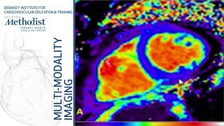 Heart Failure II How to Evaluate Diastolic Function Nagueh MDChamsiPasha MD January 15 2019 [upl. by Atarman]