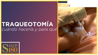 ¿Qué es la traqueotomía  Salud180 [upl. by Ori]