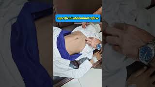 Superficial abdominal reflex eliciting method neurology pediatrics clinicalexamination [upl. by Eltsyrhc7]