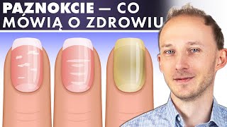 Co paznokcie mówią o Twoim zdrowiu Odczytaj choroby i niedobory z paznokci  Dr Bartek Kulczyński [upl. by Carlie]