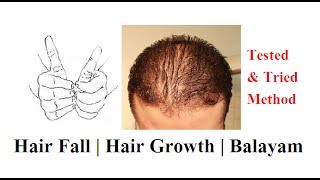 Hair grow Hair fall Balayam [upl. by Lissie922]