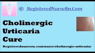 Cholinergic Urticaria Cure [upl. by Airyk]