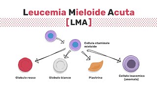 Tipi di leucemia mieloide acuta [upl. by Arekat]