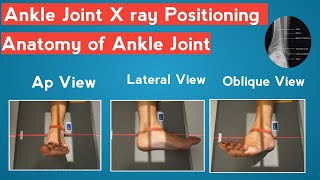 ankle joint x ray positioning  ankle joint anatomy  ankle injury [upl. by Civ]