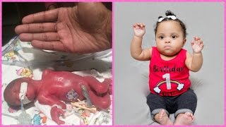 Diors Journey  Preemie Born at 23 Weeks [upl. by Nekal]