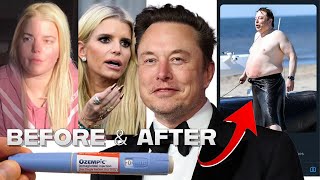 Ozempic Celebrities  BEFORE amp AFTER  Elon Musk Kelly Clarkson Jessica Simpson and MORE [upl. by Ylhsa48]