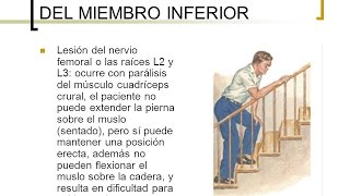 Lesion nervio Crural  Manejo en casa recomendaciones [upl. by Kay62]