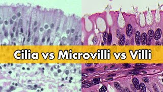 Cilia vs Microvilli vs Villi [upl. by Cecilio404]