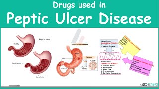 Drugs Used in Treament of Peptic Ulcer Diseae Pharmacology [upl. by Turk]