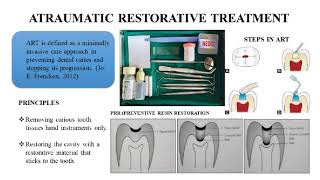 ATRAUMATIC RESTORATIVE TREATMENT [upl. by Kienan]