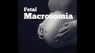 Fetal Macrosomia [upl. by Fotina]