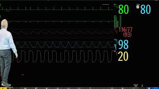 Philips IntelliVue Patient Monitoring  1  Introduction to Basic Operation [upl. by Dale]