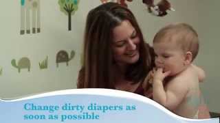 How to treat diaper rash [upl. by Salta]