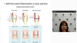 Diagnosing and managing psoriatic arthritis [upl. by Hinckley]