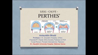 Legg  Calve  Perthes Disease  Concept amp Diagnoses In Depth Lecture by Prof Anisuddin Bhatti [upl. by Yadnus]