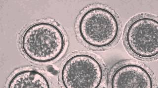 Mouse Oocytes Undergoing Meiosis [upl. by Drofdeb]