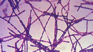 Anthrax and Bacillus anthracis [upl. by Greenberg]