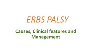 Erbs palsy causes clinical presentation and management [upl. by Tamqrah]