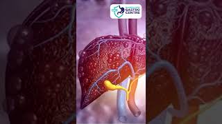 The SHOCKING Truth About Fatty Liver Symptoms [upl. by Orodisi]