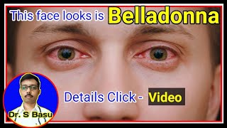 Belladonna homeopathic medicine symptom  Belladonna  Dr S Basu [upl. by Narton]