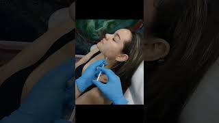 All you need to know about Masseter Muscle Botox in West Palm Beach Gardens shorts [upl. by Nnaylime416]