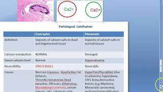 Pathology 052 a Pathologic Calcification Pathological Dystrophic Metastatic Compare Difference [upl. by Aynik]