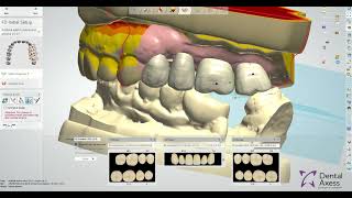 4 tooth flipper design demo [upl. by Calderon]