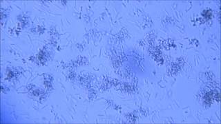 LACTOBACILLUS ACIDOPHILUS  LACTOBACILLUS RHAMNOSUS [upl. by Rai732]