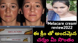 melacare క్రీమ్ genuine రివ్యూ in2022 how to use melacare creamMelacare usesampside effects 👍👎 [upl. by Donatelli]