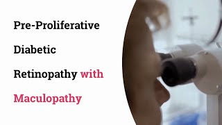 Preproliferative diabetic retinopathy with Maculopathy [upl. by Den]