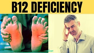 Vitamin B12 deficiency symptoms  Vitamin B12 foods  Increase vitamin B12 naturallyVitamins B12 [upl. by Tema]