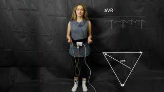 ECG The augmented limb leads aVF aVR and aVL [upl. by Sylvie918]