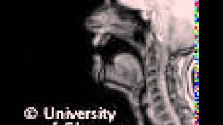 MRI voiced bilibial implosive [upl. by Calvano839]