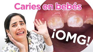 CARIES EN BEBES todo lo que debes saber [upl. by Uta]