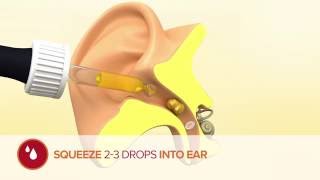 How to use Otex Olive Oil Ear Drops [upl. by Sou]